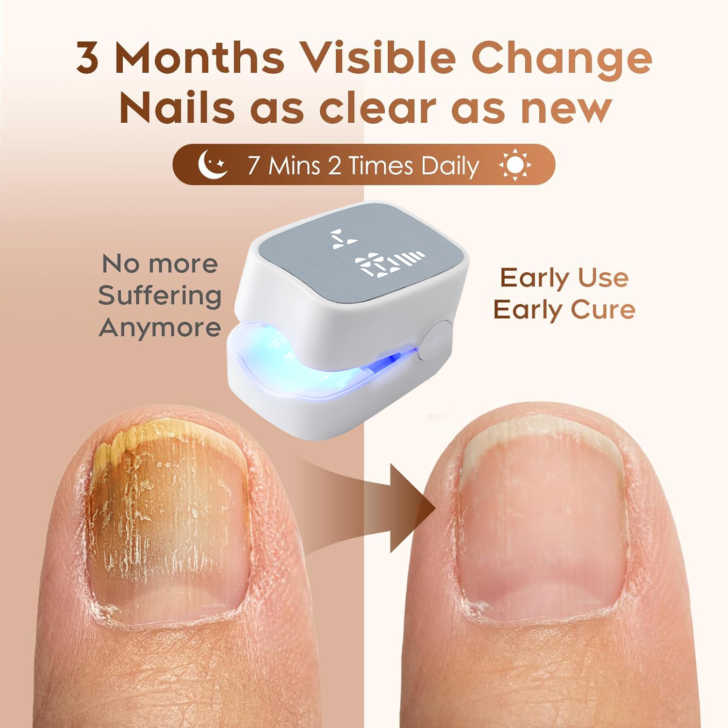 Home Use Onychomycosis Therapy - огляд і ціна Galvanic Skin Sensor